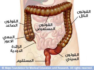 صورة توضيحية للأمعاء الغليظة