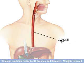 صورة توضيحية للمريء