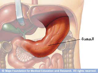 صورة توضيحية للمعدة